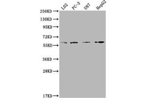 Western Blot Positive WB detected in: L02 whole cell lysate, PC-3 whole cell lysate, U87 whole cell lysate, HepG2 whole cell lysate All lanes: ICAM3 antibody at 1:2000 Secondary Goat polyclonal to rabbit IgG at 1/50000 dilution Predicted band size: 60 kDa Observed band size: 60 kDa (ICAM-3/CD50 Antikörper  (AA 200-547))
