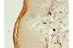 Immunohistochemistry of paraffin-embedded human skin tissue using ABIN7151288 at dilution of 1:100 (TRIM9 Antikörper  (AA 1-550))