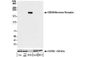 Western Blotting (WB) image for anti-Mannose Receptor, C Type 1 (MRC1) (AA 1406-1456) antibody (ABIN7455101)
