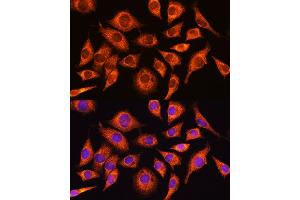 Immunofluorescence analysis of L929 cells using PPP1R15A Rabbit pAb (ABIN7269676) at dilution of 1:100. (GADD34 Antikörper  (AA 375-674))