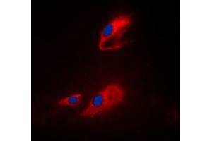 Immunofluorescent analysis of ACOT8 staining in Raji cells.