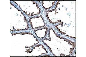 IHC analysis of AS160/TBC1D4 using anti-AS160/TBC1D4 antibody (ABIN7599745). (TBC1D4 Antikörper  (AA 1118-1298))