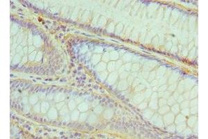 Immunohistochemistry (IHC) image for anti-Core-Binding Factor, beta Subunit (CBFB) (AA 1-182) antibody (ABIN7148567)