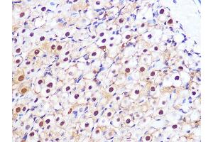 Immunohistochemistry of paraffin-embedded rat ovary using PSM Rabbit mAb (ABIN7269600) at dilution of 1:100 (40x lens). (PSMA3 Antikörper)