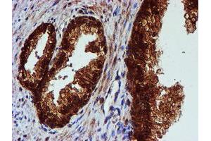 Image no. 3 for anti-Chromosome 1 Open Reading Frame 50 (C1ORF50) antibody (ABIN1497033)