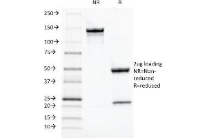 SDS-PAGE Analysis Purified TOX3 Mouse Monoclonal Antibody (TOX3/1124). (TOX3 Antikörper  (AA 251-389))