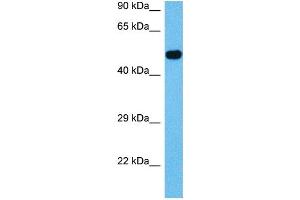 Western Blotting (WB) image for anti-Activin Receptor Type I (ACRV1) (N-Term) antibody (ABIN2782109)