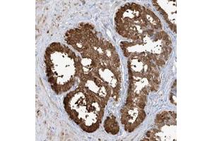 Immunohistochemical staining of human liver with TGM4 polyclonal antibody  shows strong cytoplasmic positivity in glandular cells. (TGM4 Antikörper)