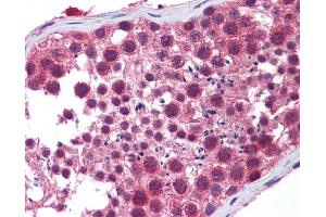 Immunohistochemistry (IHC) image for anti-Histone Deacetylase 6 (HDAC6) (N-Term) antibody (ABIN616900) (HDAC6 Antikörper  (N-Term))
