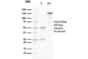 SDS-PAGE Analysis Purified PAPP-A Mouse Monoclonal Antibody (PAPPA/2716). (PAPPA Antikörper  (AA 351-523))