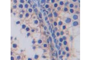 IHC-P analysis of Kidney tissue, with DAB staining. (SLC2A14 Antikörper  (AA 1-105))