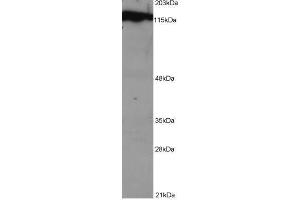 Image no. 1 for anti-Damage Specific DNA Binding Protein 1 (DDB1) (C-Term) antibody (ABIN374069) (DDB1 Antikörper  (C-Term))