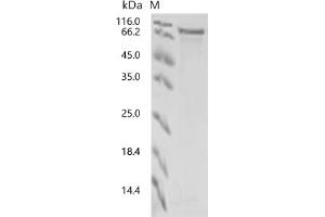 (Tris-Glycine gel) Discontinuous SDS-PAGE (reduced) with 5 % enrichment gel and 15 % separation gel.