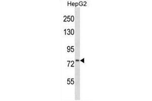 CD106 Antibody (Center) western blot analysis in HepG2 cell line lysates (35µg/lane). (VCAM1 Antikörper  (Middle Region))