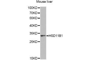 Western blot analysis of extracts of mouse liver, using HSD11B1 antibody. (HSD11B1 Antikörper)