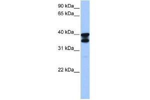 SLC25A31 antibody used at 1 ug/ml to detect target protein.