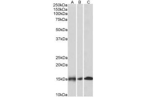 AP32031PU-N NDUFA7 Antibody staining of Human (A), Mouse (B) and Rat (C) Heart lysates (35µg protein in RIPA buffer) at 0. (NDUFA7 Antikörper  (Internal Region))