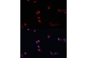 Immunofluorescence analysis of HeLa cells using Catalasealase antibody (ABIN6133450, ABIN6137987, ABIN6137989 and ABIN6215464) at dilution of 1:100.