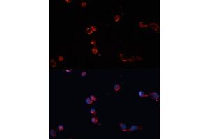 Immunofluorescence analysis of HeLa cells using Catalasealase antibody (ABIN6133450, ABIN6137987, ABIN6137989 and ABIN6215464) at dilution of 1:100. (Catalase Antikörper  (AA 1-225))
