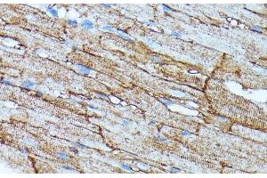 Immunohistochemistry of paraffin-embedded Rat heart using SLC14A1 Polyclonal Antibody at dilution of 1:100 (40x lens).