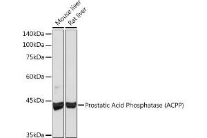 Western blot analysis of extracts of various cell lines, using Prostatic Acid Phosphatase (ACPP) (PAP/ACPP) Rabbit mAb (ABIN1683136, ABIN3018597, ABIN3018598 and ABIN7101633) at 1:1000 dilution. (ACPP Antikörper)