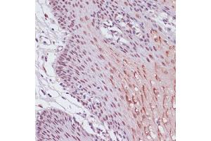Immunohistochemistry (IHC) image for anti-Lysine (K)-Specific Demethylase 1A (KDM1A) (AA 130-380) antibody (ABIN7268323)