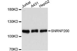 Western blot analysis of extracts of various cell lines, using SNRNP200 antibody (ABIN1877090) at 1:3000 dilution. (SNRNP200 Antikörper)