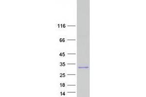 Western Blotting (WB) image for Vitamin K-dependent protein C (PROC) (Transcript Variant 1) protein (Myc-DYKDDDDK Tag) (ABIN2729572)