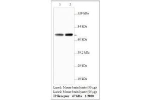 Image no. 1 for anti-Prostacyclin Receptor (PTGIR) antibody (ABIN791360) (Prostacyclin Receptor Antikörper)