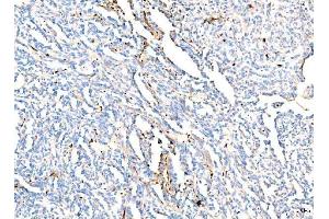 IHC analysis of Hemoglobin/HBA1/HBA2 using anti-Hemoglobin/HBA1/HBA2 antibody (ABIN7602893).