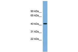 WB Suggested Anti-WDFY1 Antibody Titration: 0. (WDFY1 Antikörper  (N-Term))