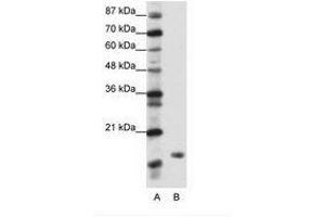 Image no. 1 for anti-TATA-Binding Protein-Associated Phosphoprotein (DR1) (N-Term) antibody (ABIN202041) (DR1 Antikörper  (N-Term))