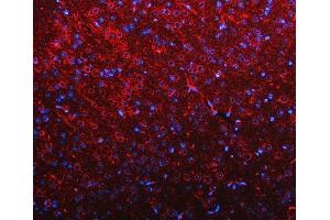 IF analysis of RIMBP2 using anti-RIMBP2 antibody (ABIN7601441). (RIMBP2 Antikörper  (AA 351-1049))