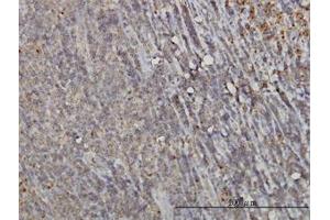 Image no. 1 for anti-RAB6A, Member RAS Oncogene Family (RAB6A) (AA 109-208) antibody (ABIN598568) (RAB6A Antikörper  (AA 109-208))