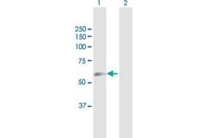 Western Blot analysis of GGT5 expression in transfected 293T cell line by GGT5 MaxPab polyclonal antibody. (GGT5 Antikörper  (AA 1-587))