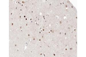 ABIN6266561 at 1/100 staining human brain tissue sections by IHC-P. (HDAC9 Antikörper  (C-Term))