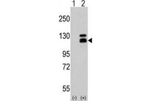 Western blot analysis of Parg Antibody (C-term) in 293 cell line lysates (35 µg/lane). (PARG Antikörper  (C-Term))