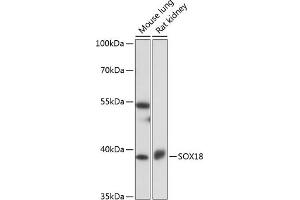 Western blot analysis of extracts of various cell lines, using SOX18 antibody (ABIN7270572) at 1:1000 dilution. (SOX18 Antikörper  (AA 1-100))