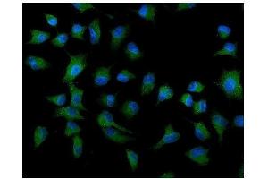 IF analysis of ATG9A using anti-ATG9A antibody (ABIN7599557).