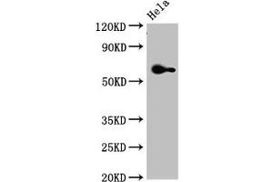 Western Blot Positive WB detected in: Hela whole cell lysate All lanes: FZD4 antibody at 3. (FZD4 Antikörper  (AA 37-222))