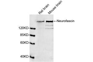 Western blot analysis of tissue lysates using 1 µg/mL Rabbit Anti-Neurofascin Polyclonal Antibody (ABIN398840) The signal was developed with IRDyeTM 800 Conjugated Goat Anti-Rabbit IgG. (NFASC Antikörper  (N-Term))