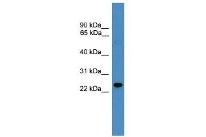 RAB9B antibody used at 0. (RAB9B Antikörper  (N-Term))