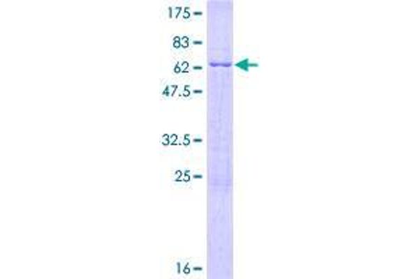 DIMT1 Protein (AA 1-313) (GST tag)