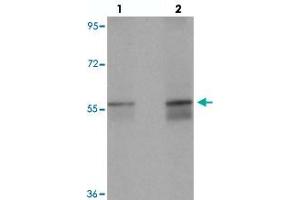 Western blot analysis of NETO1 in human lung tissue with NETO1 polyclonal antibody  at (lane 1) 1 and (lane 2) 2 ug/mL. (NETO1 Antikörper  (C-Term))