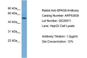 WB Suggested Anti-SPAG6  Antibody Titration: 0. (SPAG6 Antikörper  (Middle Region))
