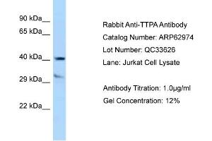 Western Blotting (WB) image for anti-Tocopherol (Alpha) Transfer Protein (TTPA) (C-Term) antibody (ABIN2789318)