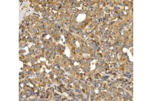 IHC analysis of MLX-interacting protein/MLXIP using anti-MLX-interacting protein/MLXIP antibody (ABIN7602593). (MLXIP Antikörper  (AA 88-348))