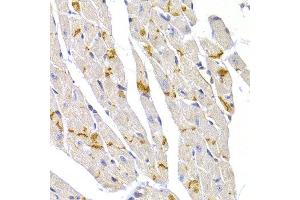 Immunohistochemistry of paraffin-embedded mouse heart using DSP antibody at dilution of 1:100 (40x lens).