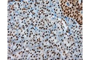 Immunohistochemical staining of paraffin-embedded colon tissue using anti-MCL1 mouse monoclonal antibody. (MCL-1 Antikörper)