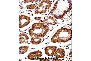 CTNNB1 Antibody (C-term) immunohistochemistry analysis in formalin fixed and paraffin embedded human stomach tissue followed by peroxidase conjugation of the secondary antibody and DAB staining. (CTNNB1 Antikörper  (C-Term))